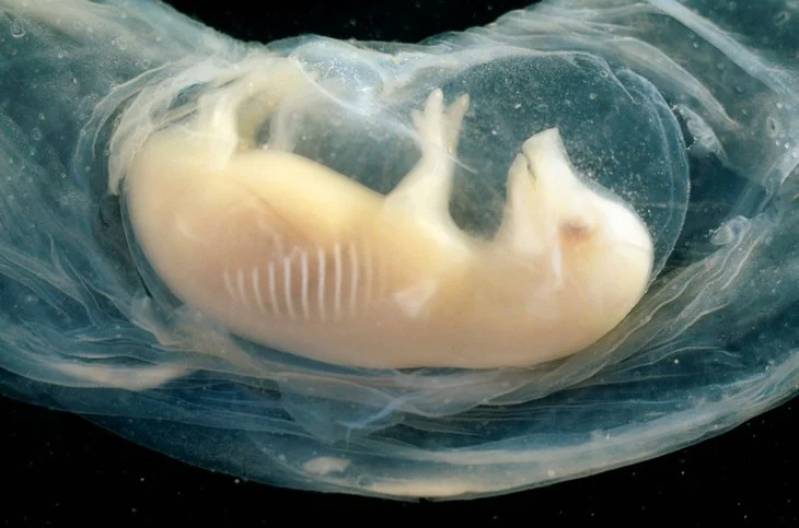 Tiny Human Hearts Grown in Pig Embryos for the First Time: A Glimmer of Hope in the Organ Shortage Crisis