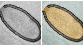 Scientists Revive 48,500-Year-Old ‘Zombie Virus’ From Siberian Permafrost