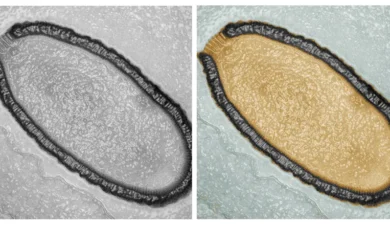 Scientists Revive 48,500-Year-Old ‘Zombie Virus’ From Siberian Permafrost