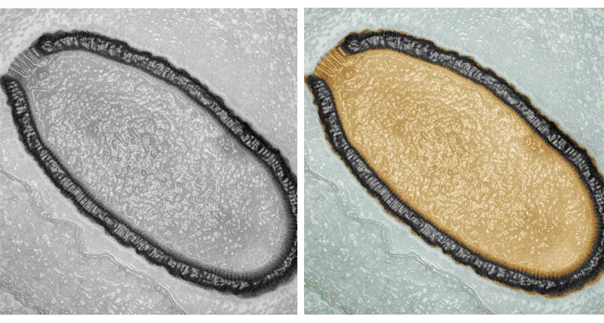 Scientists Revive 48,500-Year-Old ‘Zombie Virus’ From Siberian Permafrost